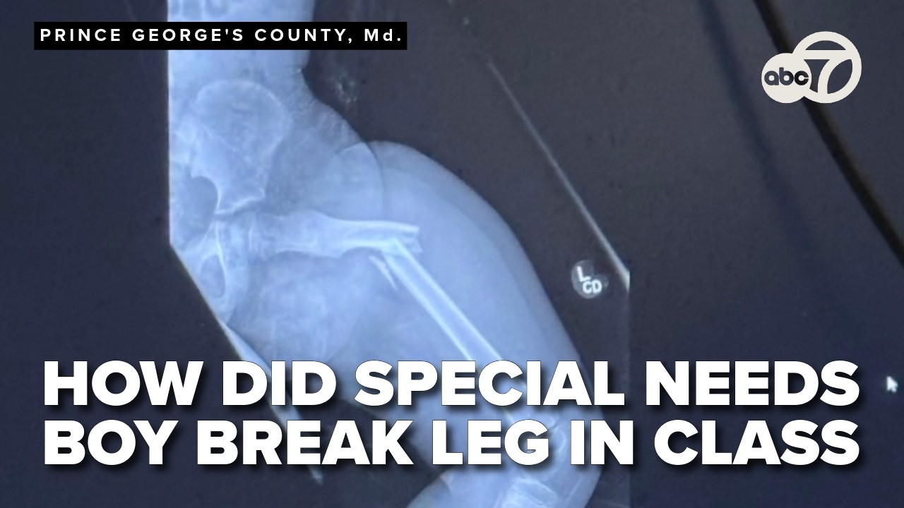 How did special needs boy breaks leg in class