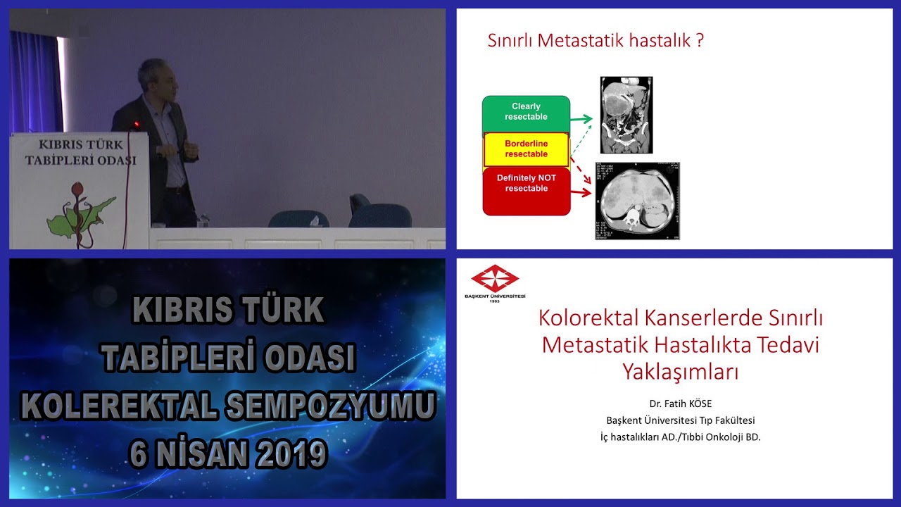 Dr  Fatih KÖSE Kolorektal Kanserlerde Sınırlı Metastatik Hastalıkta Tedavi Yaklaşımları
