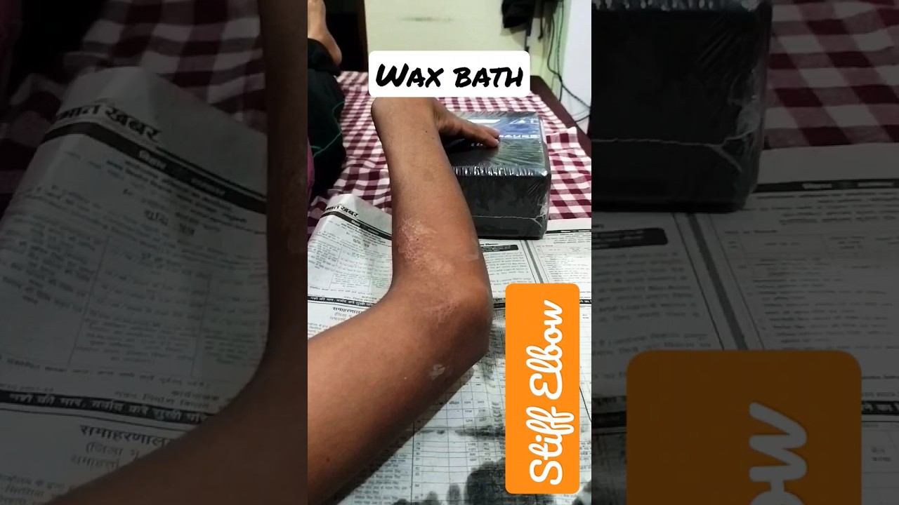 Wax Bath therapy for stiffness in elbow joint #shorts #physiotherapy #viral #trending