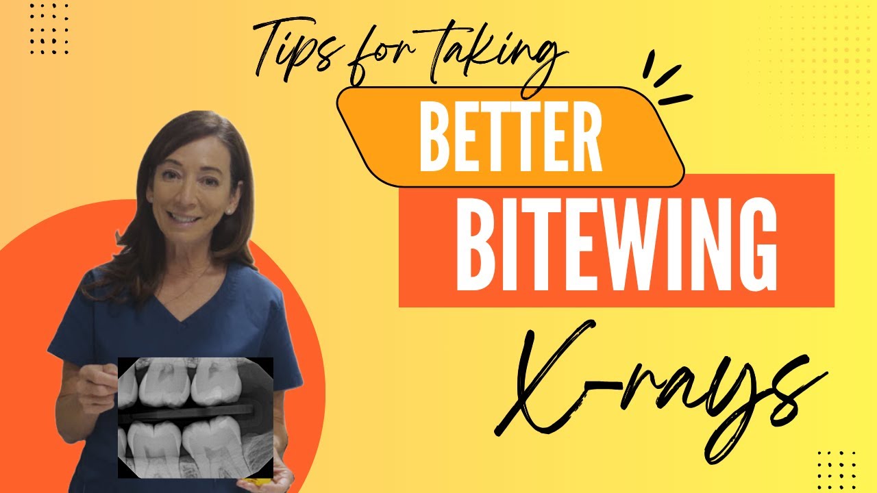 Three secrets to taking Better Bitewing X-rays