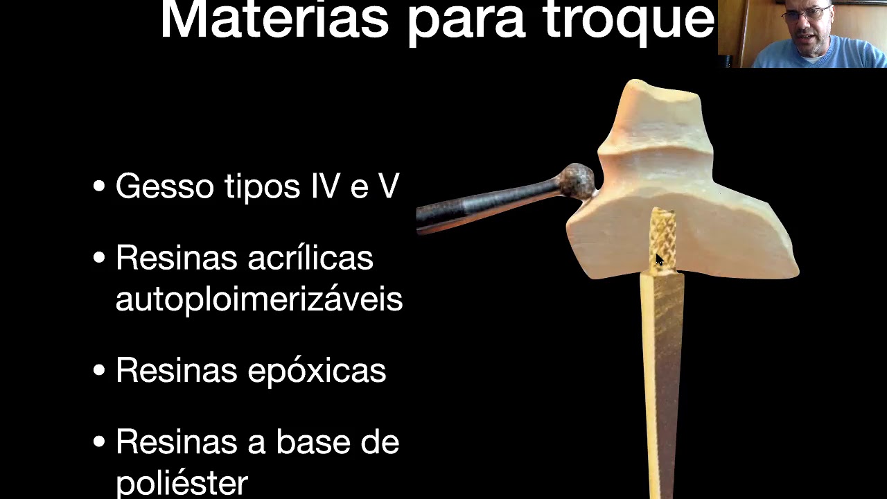 Fundição em Odontologia