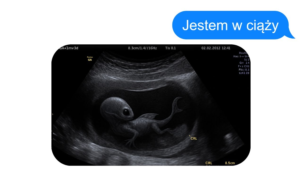 NOWY GATUNEK: Horror o Eksperymentalnej Klinice Płodności (Pełna historia SMS)