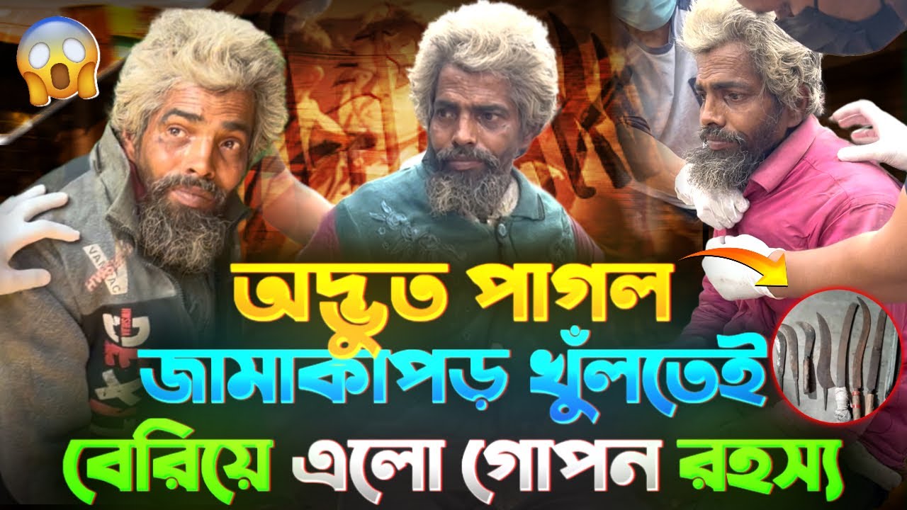 অদ্ভুত পাগল জামাকাপড় খুলতেই বেরিয়ে এলো গোপন রহস্য | Street Humanity of Bangladesh