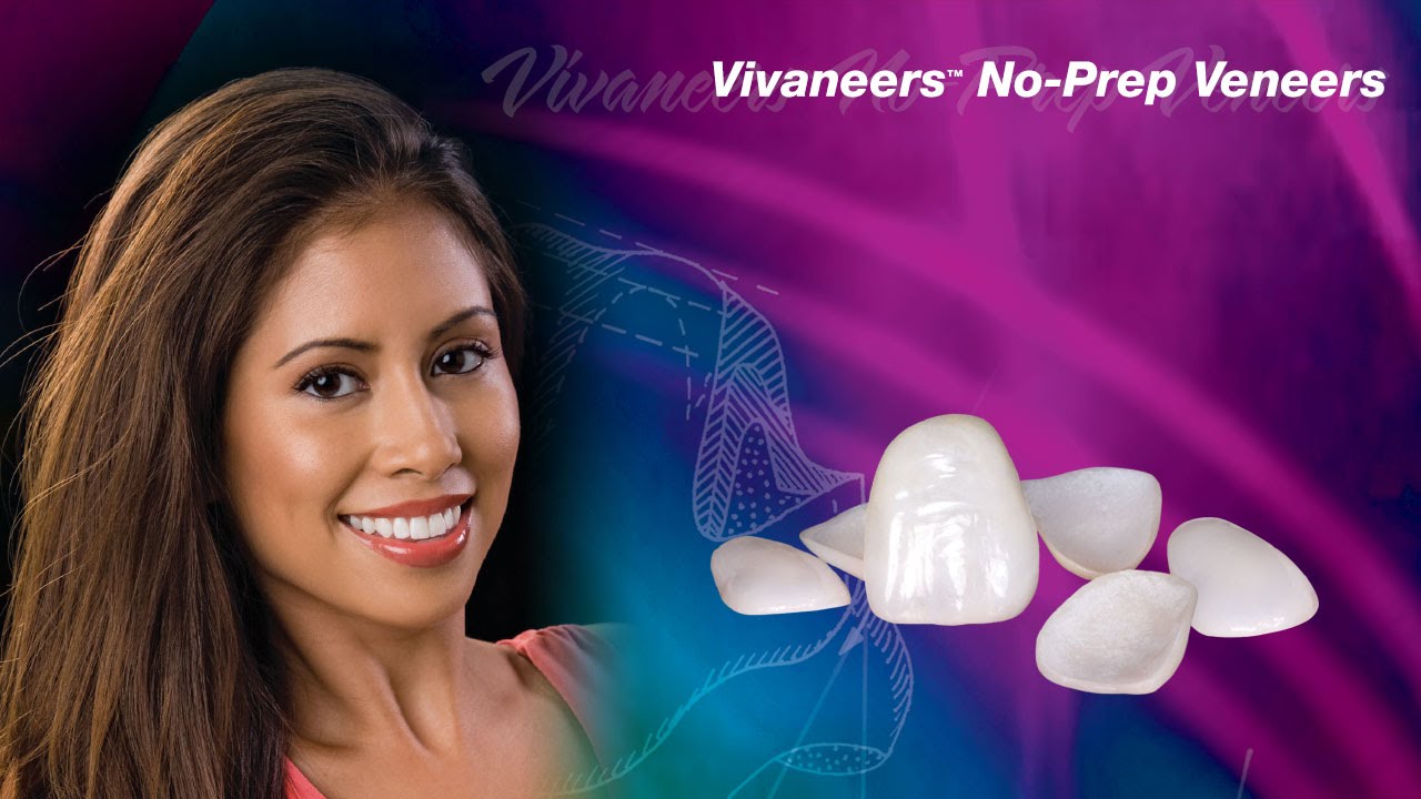 Vivaneers™ No-Prep Veneers