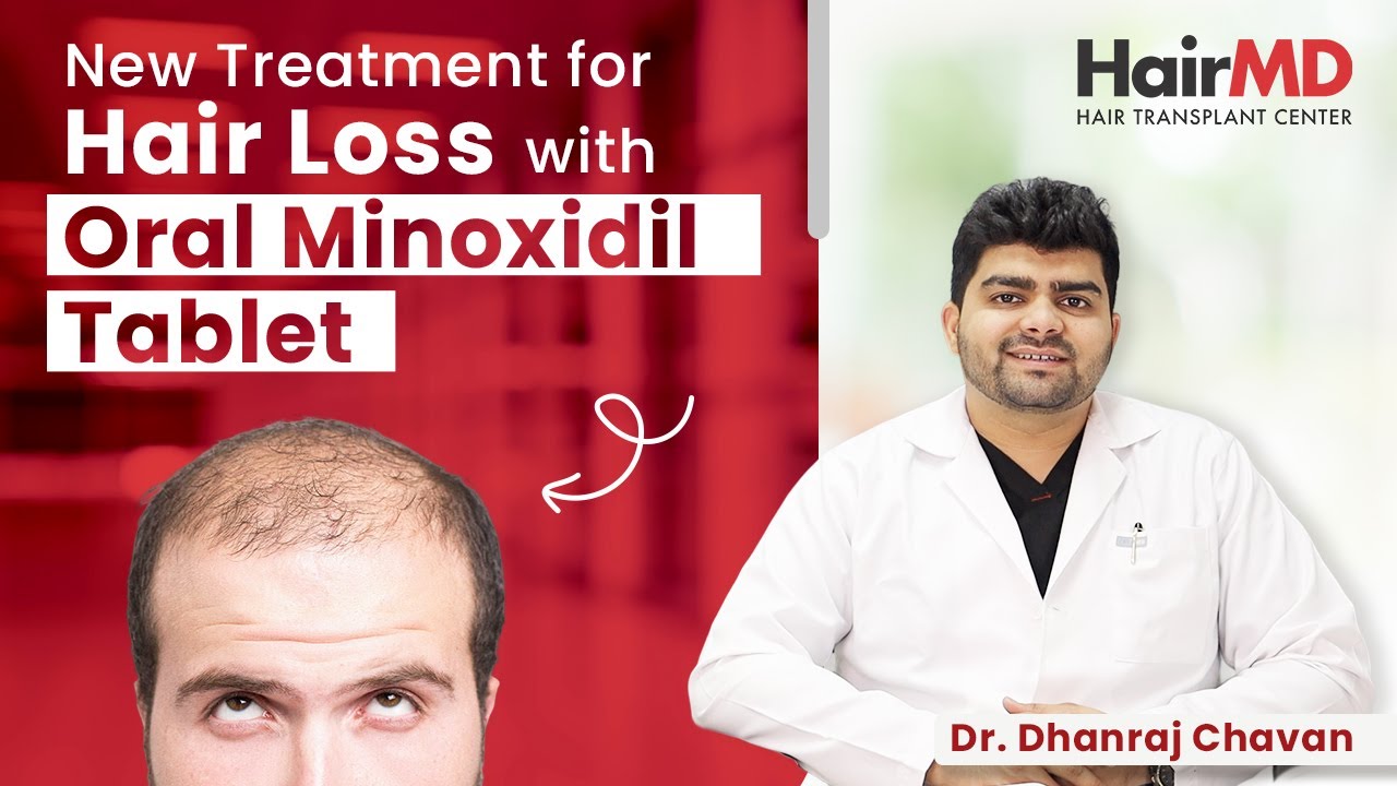 Low Dose Oral Minoxidil: Breakthrough Hair Loss Treatment | Complete Guide | HairMD, Pune