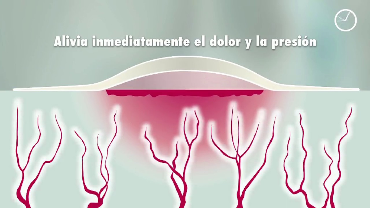 Cómo aplicar Compeed ® Ampollas