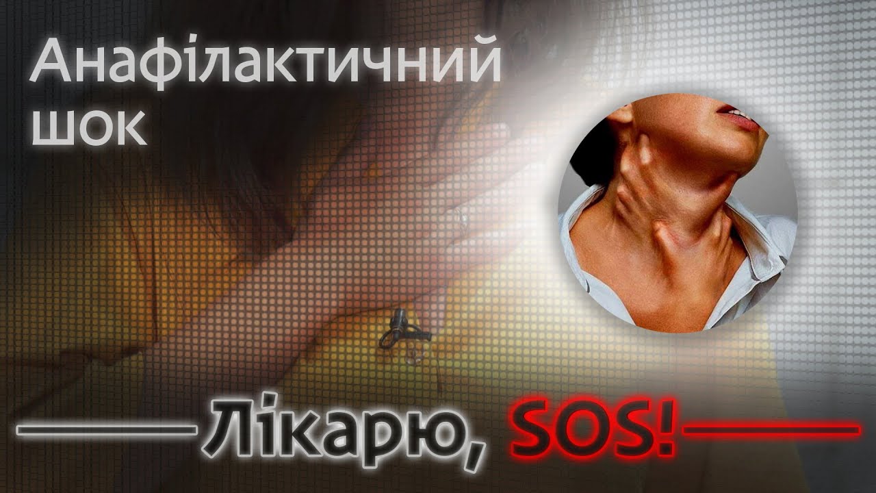 Анафілактичний шок: який єдиний препарат що рятує?