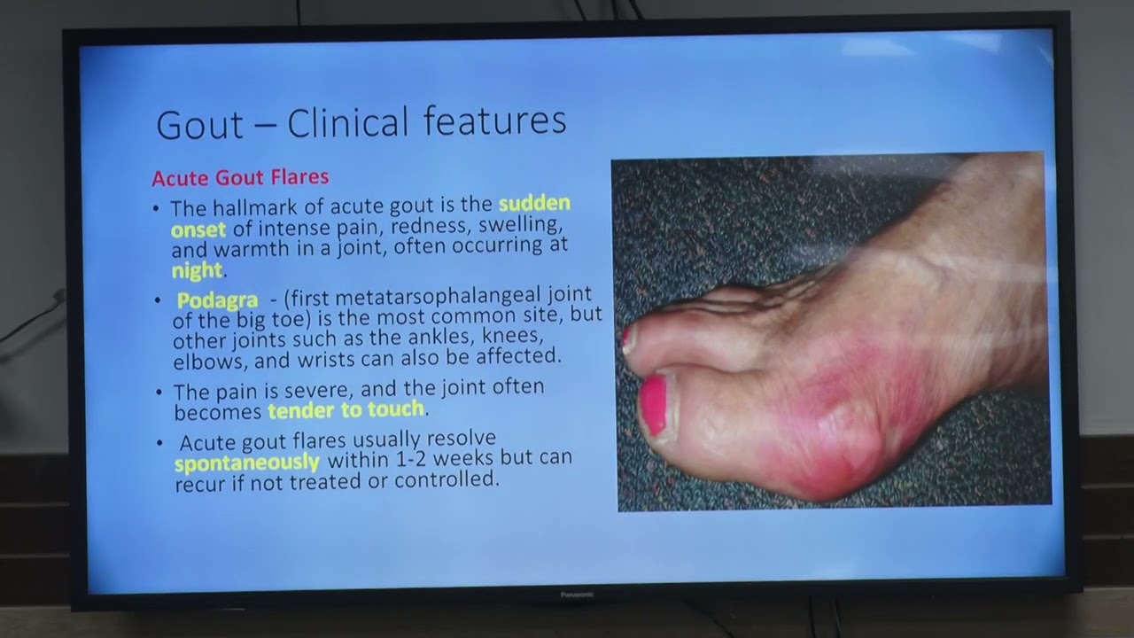 Session: Orientation of Metabolic Disorders- Modern Perspective