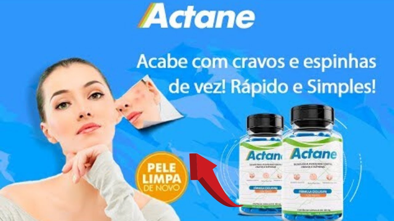 Actane Funciona? Como tomar o ACTANE ? actane onde comprar? Meu DEPOIMENTO sobre o ACNE!!!