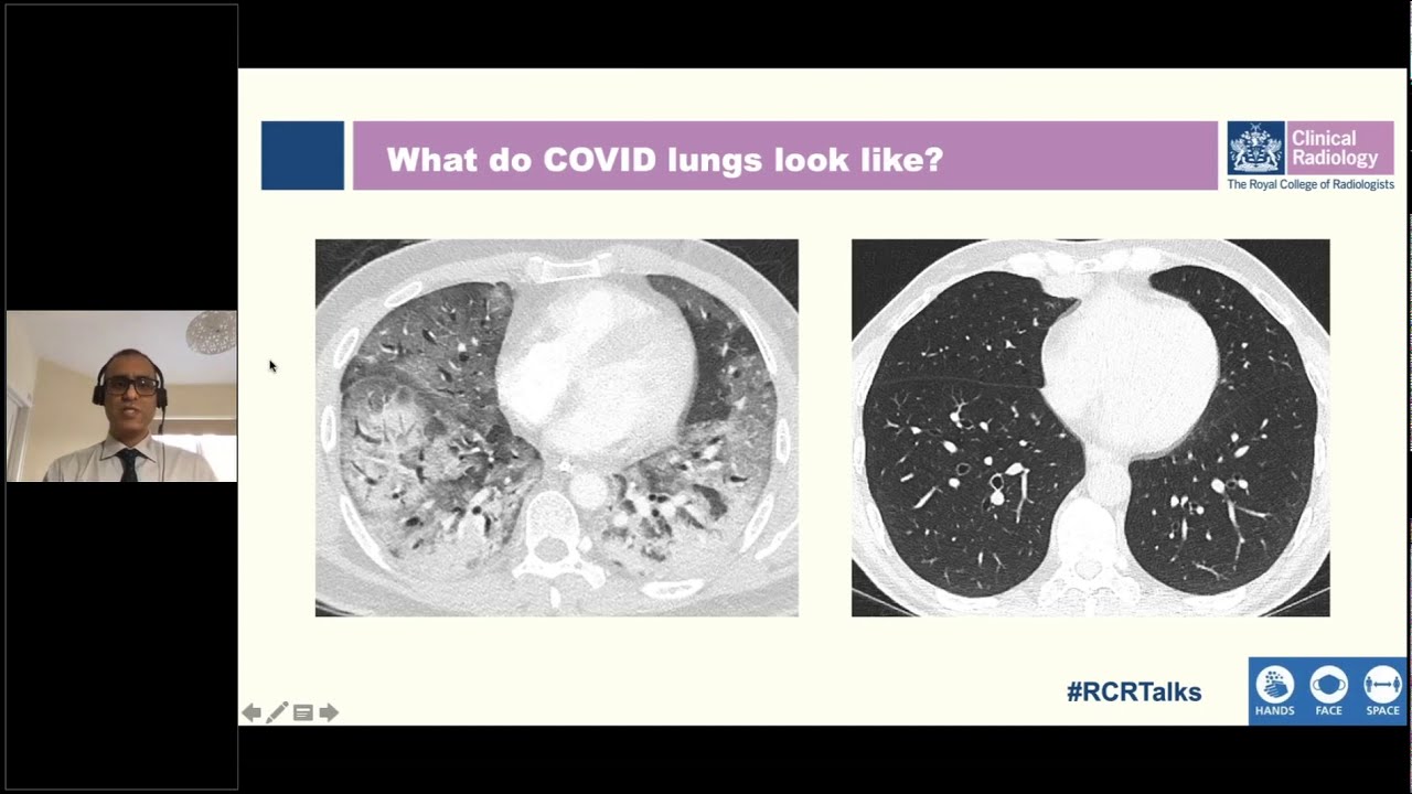 Unmasking the true face of COVID-19 through clinical imaging