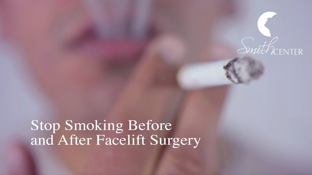 Why Smokers Should Stop Smoking Before and After Facelift Surgery - Houston Smith Center