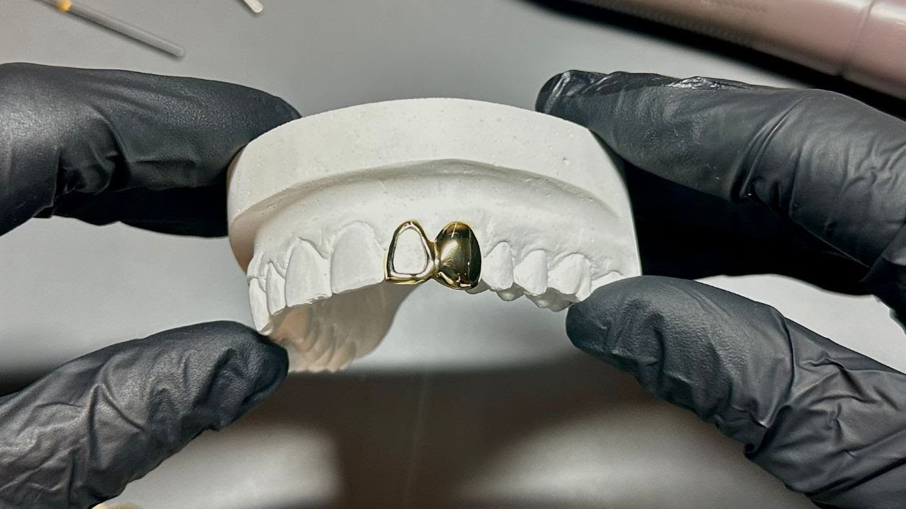 How To Make Gold-Grillz