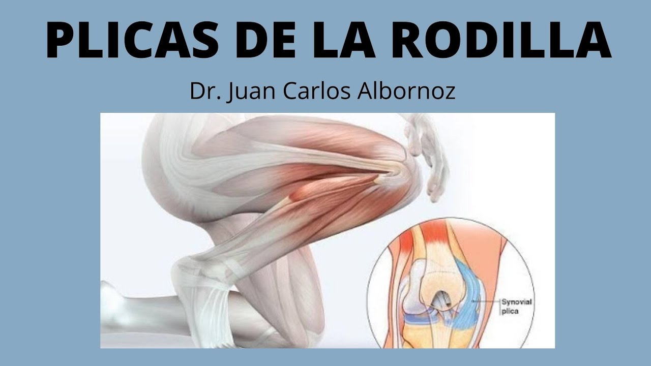 PLICA ROTULIANA #plicarotuliana #plicasinovial #plicapatelar #juancalbornoz