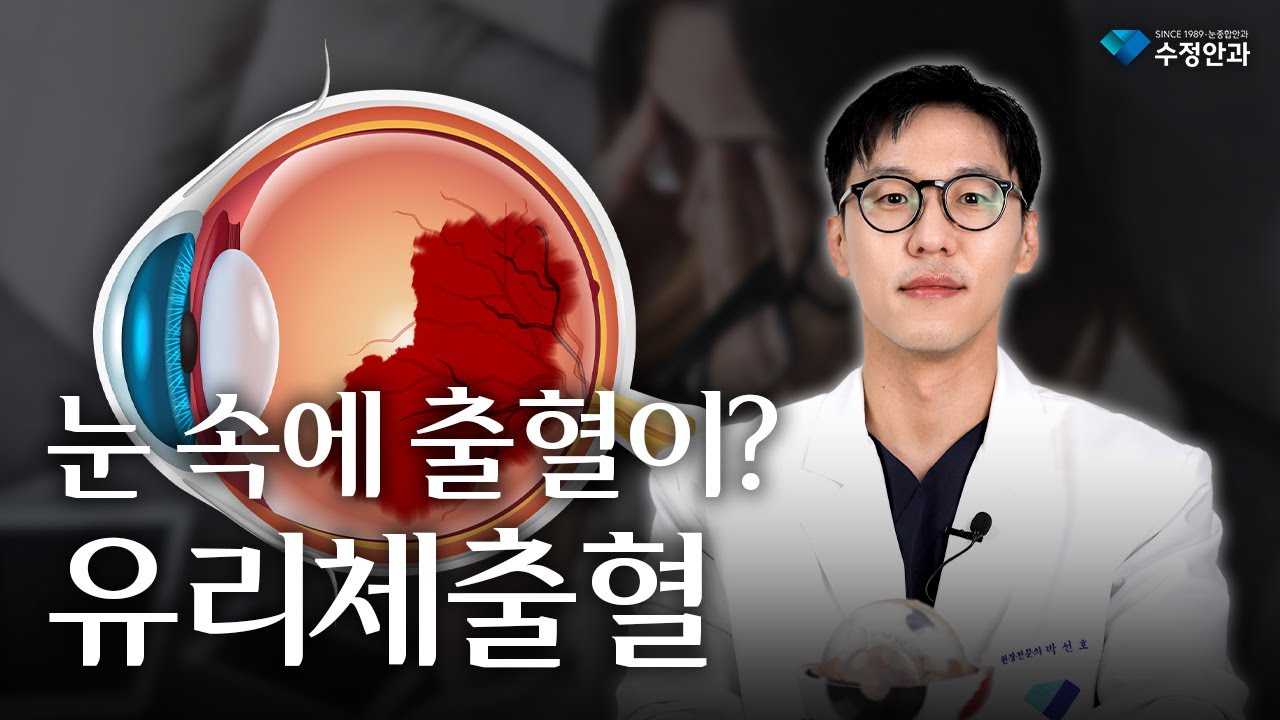 👨🏻‍⚕️눈 속에 출혈이? 유리체출혈의 모든 것!