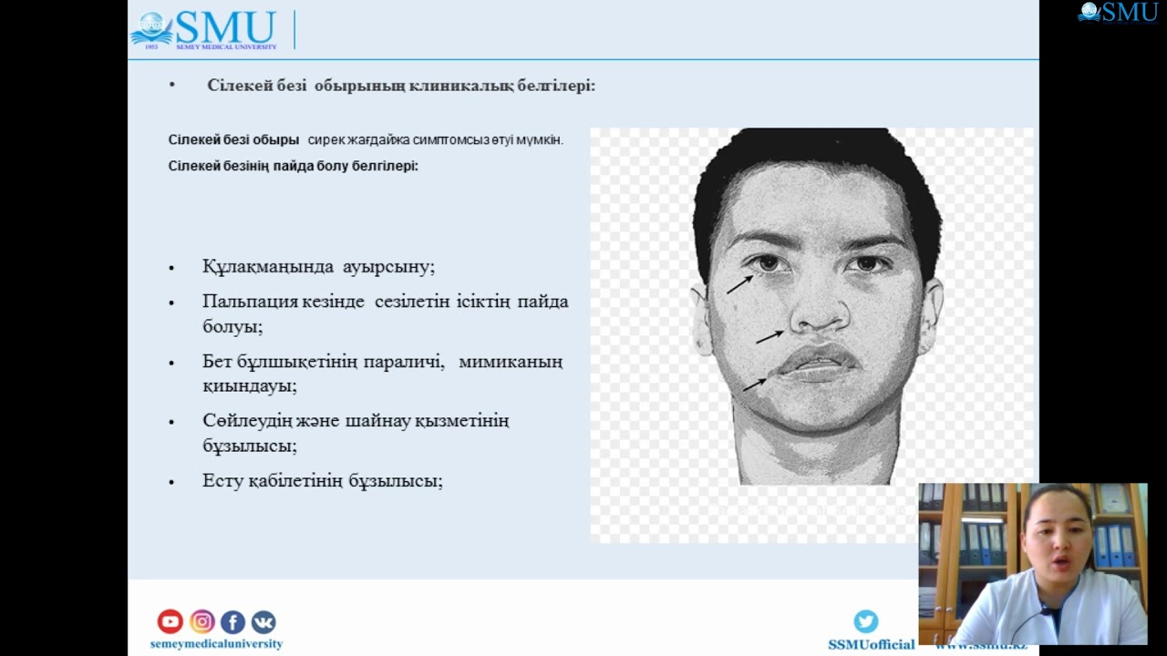 Сілекей безі обырының қатерлі ісігі