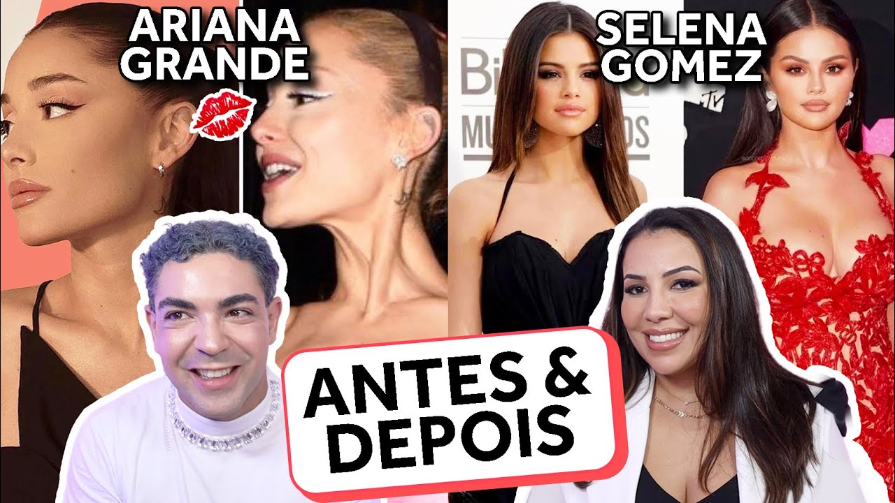 ANTES E DEPOIS DOS FAMOSOS COM OPINIÃO PROFISSIONAL! com @lapidandoautoestimas