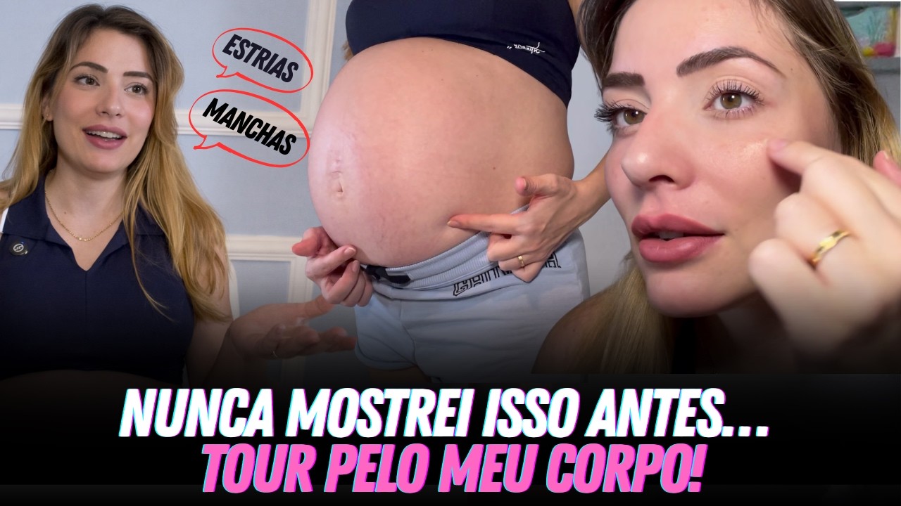 SEM FILTRO! AS MARCAS DA GRAVIDEZ QUE NINGUÉM TE CONTA!