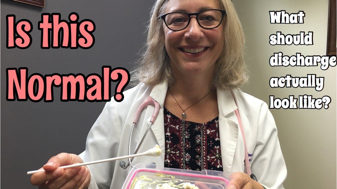 Is My Discharge Normal?