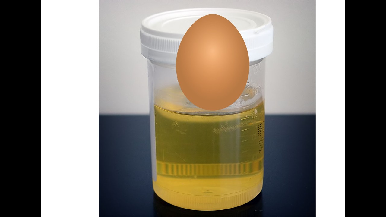 Do this to cancel bad dreams in your life. - Prophet Moses