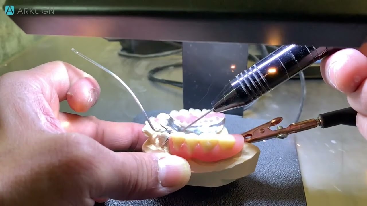 Denture welding at Arklign