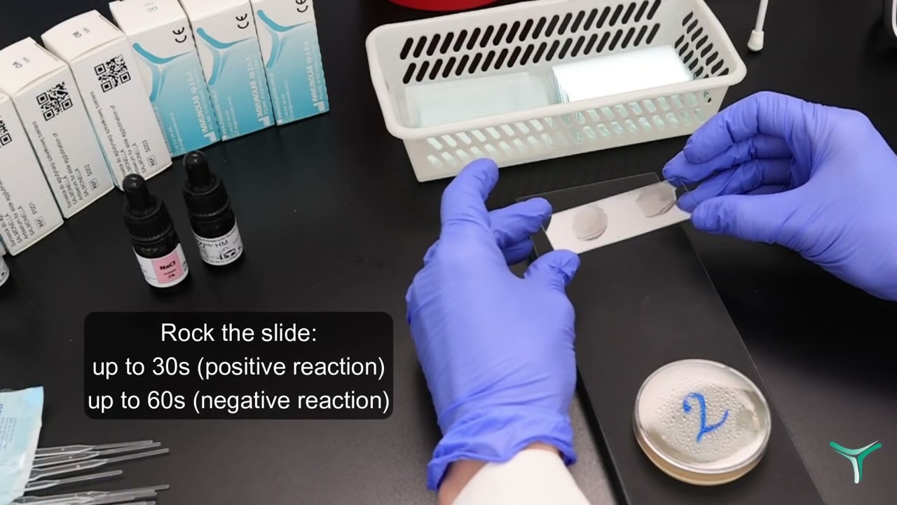 Salmonella Slide Agglutination