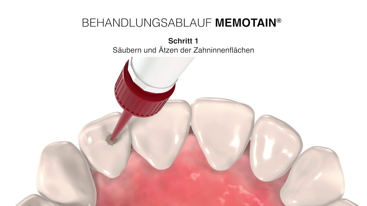 Memotain - Klebeanleitung