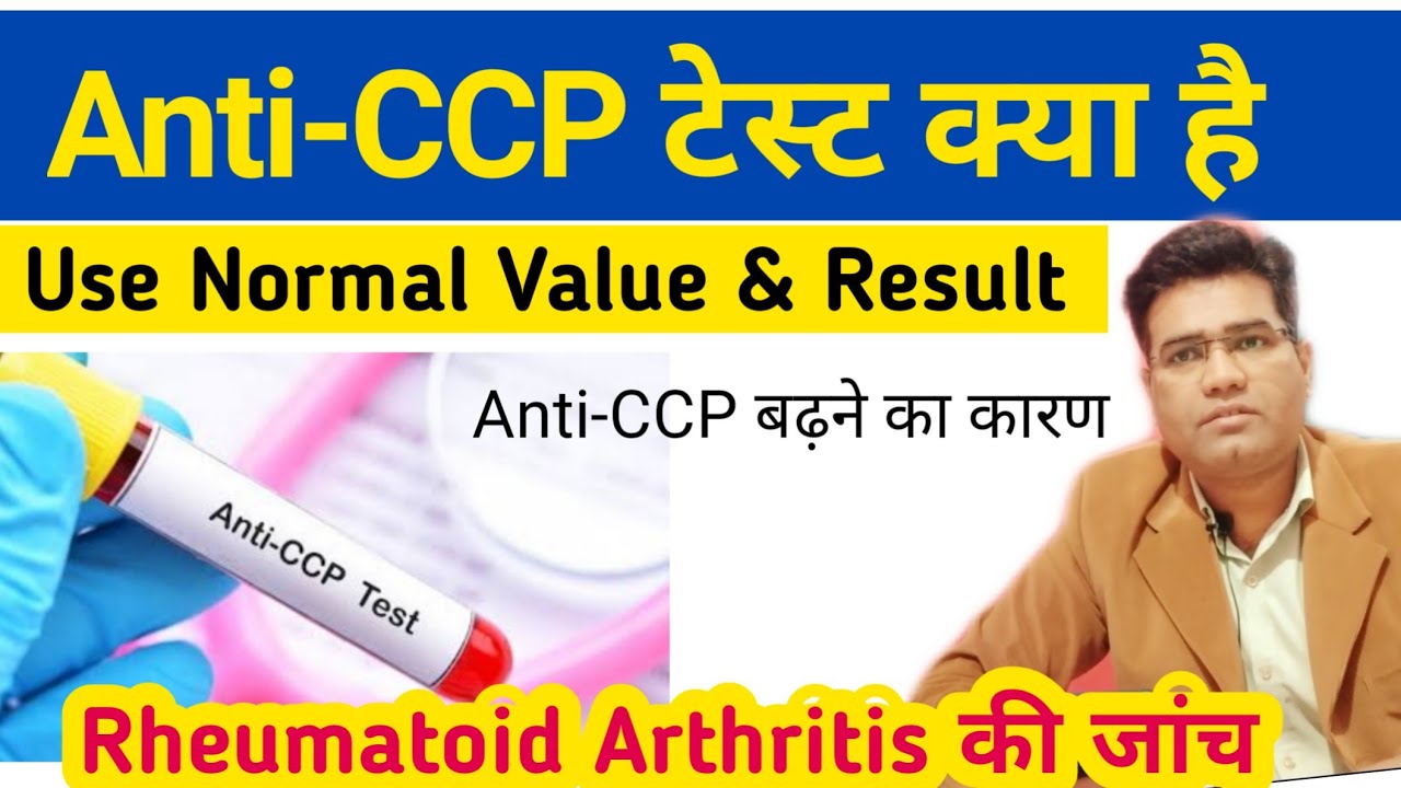 What is Anti-CCP Test Use Indications Normal Value  | Anti Cyclic Citrullinated Peptide test