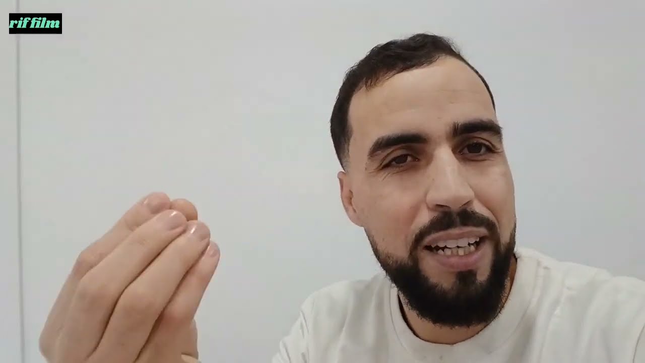 أوراق الإقامة أو بطاقة التعريف 📜 في أوروبا 🇪🇺. فيديو ممنوع 🚫 على القهويات وذوي القلوب الضعيفة 😊😊😊