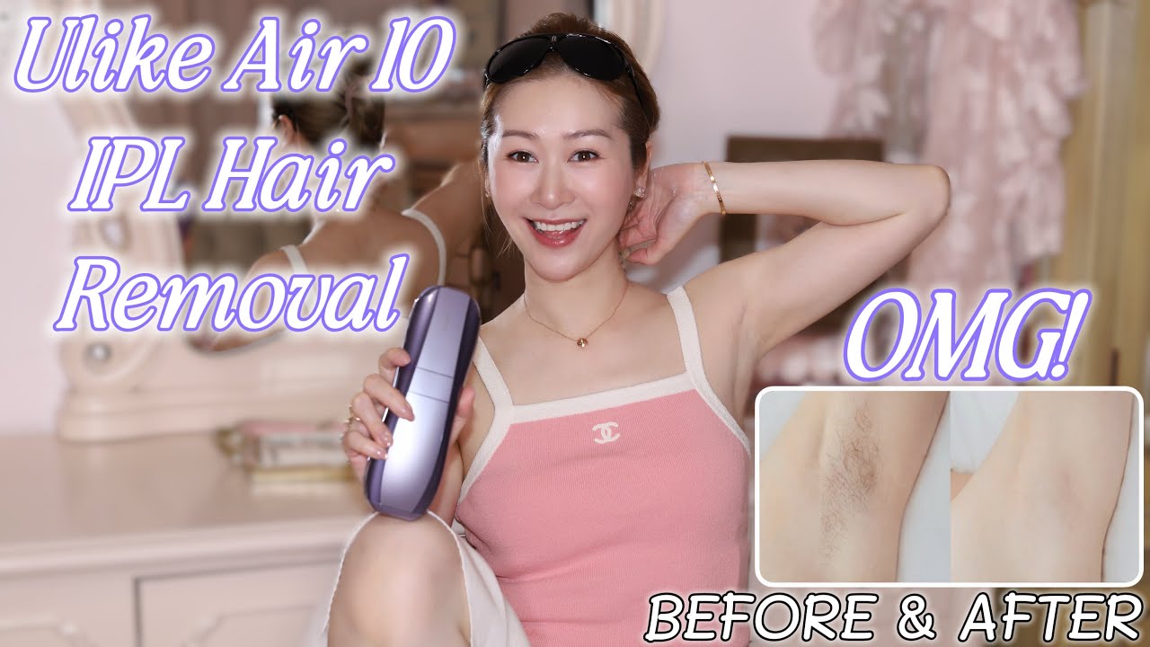 I TRIED ULIKE AIR 10 IPL HAIR REMOVAL AT HOME | MY BEST BEAUTY INVESTMENT OF 2025!! 💖  LINDIESS