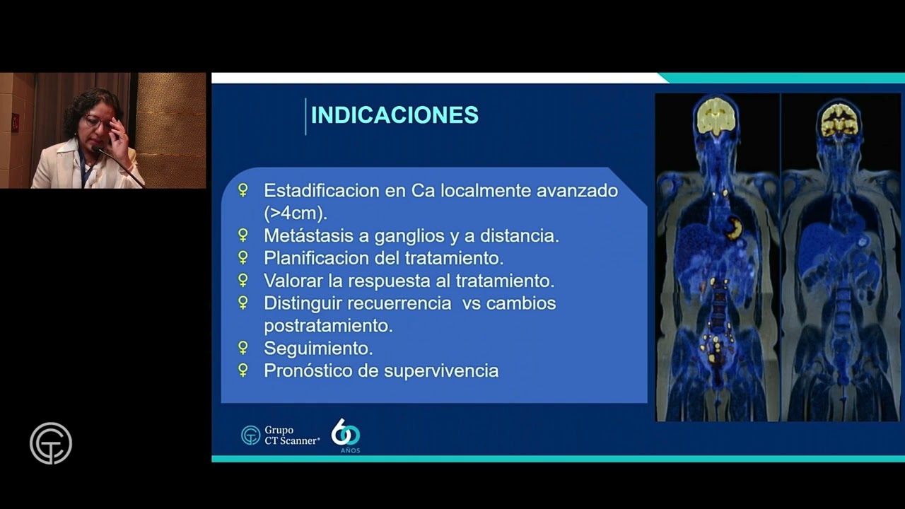PET-RM: Imagen híbrida en cáncer cérvico uterino