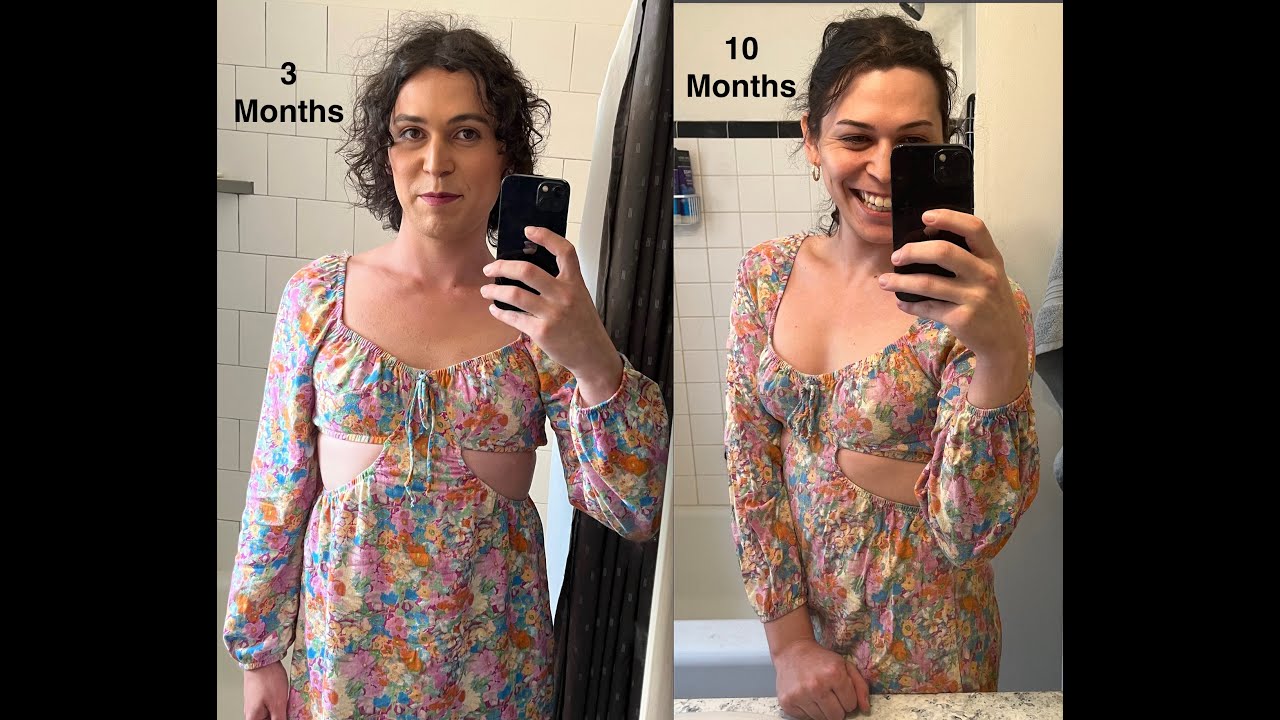 10 Month HRT Update (MtF)