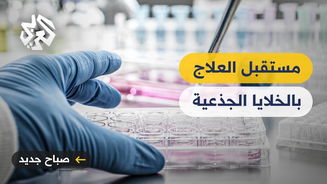 هل ينهي العلاج بالخلايا الجذعية معاناة مرضى السكري؟
