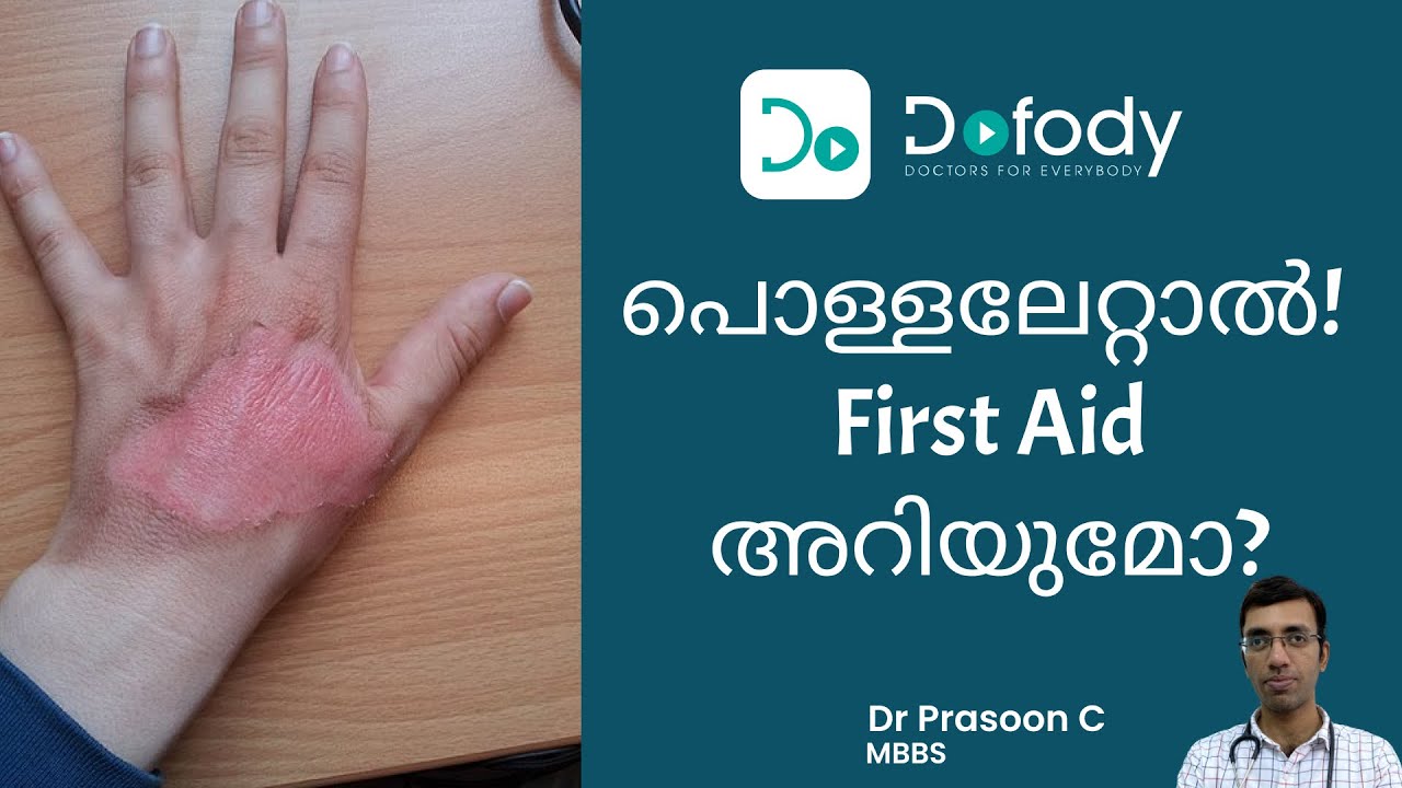 പൊള്ളലേറ്റാൽ Ice, Paste മതിയോ? |  Best Burn Ointment & First Aid of Minor Burns | Malayalam