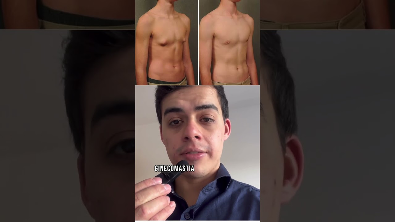 Sabia isso? #therock #celebridades #cirurgiaplastica #ginecomastia #mamas