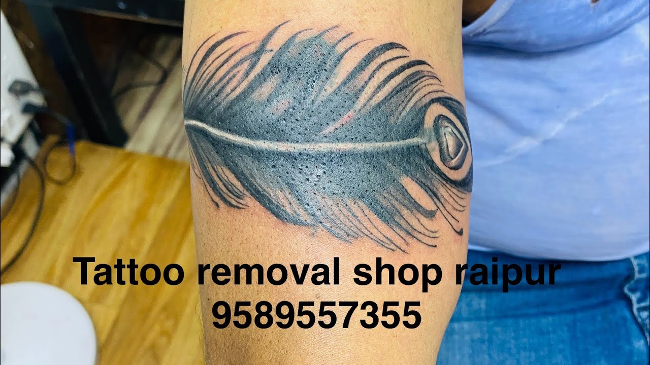 टैटू रिमूवल शॉप गोदना हटाए 9589557355