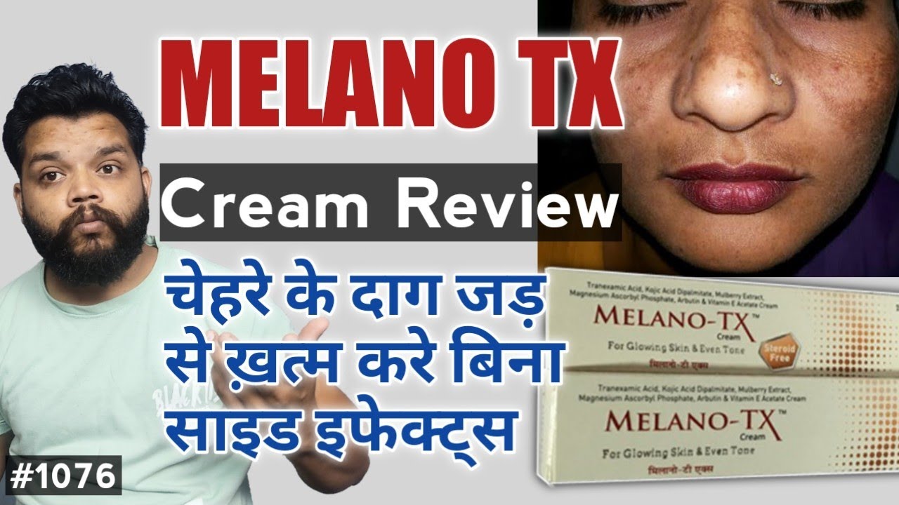 Best Cream For Melasma | Melano XT Cream Review In Hindi | Composition, Uses, Side Effects,HowbWorks