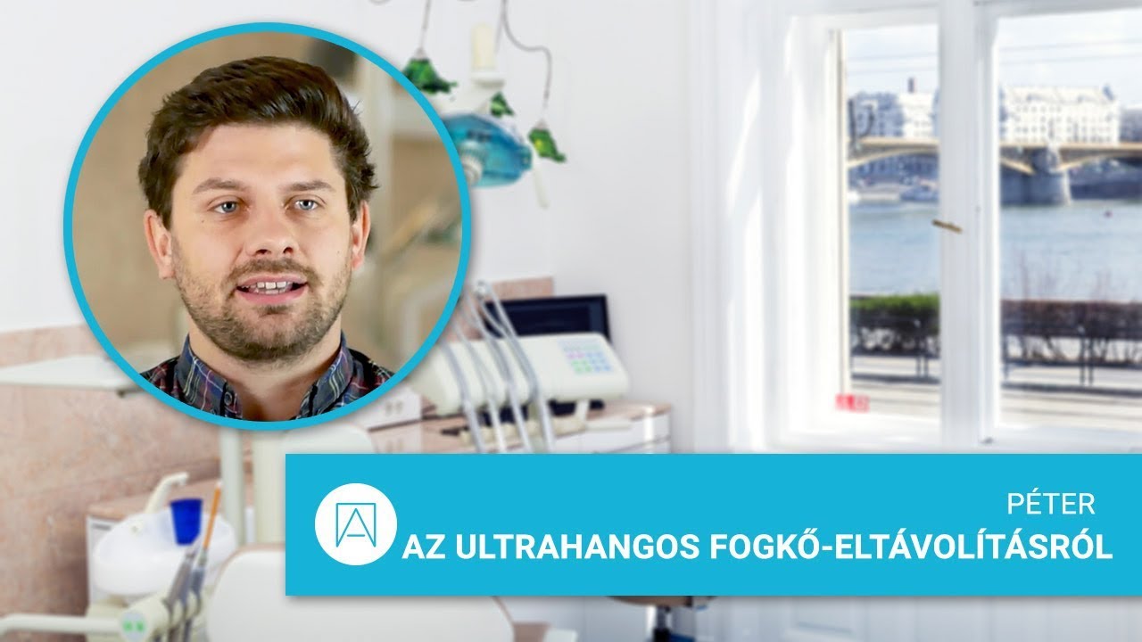 Péter az ultrahangos fogkő-eltávolításról