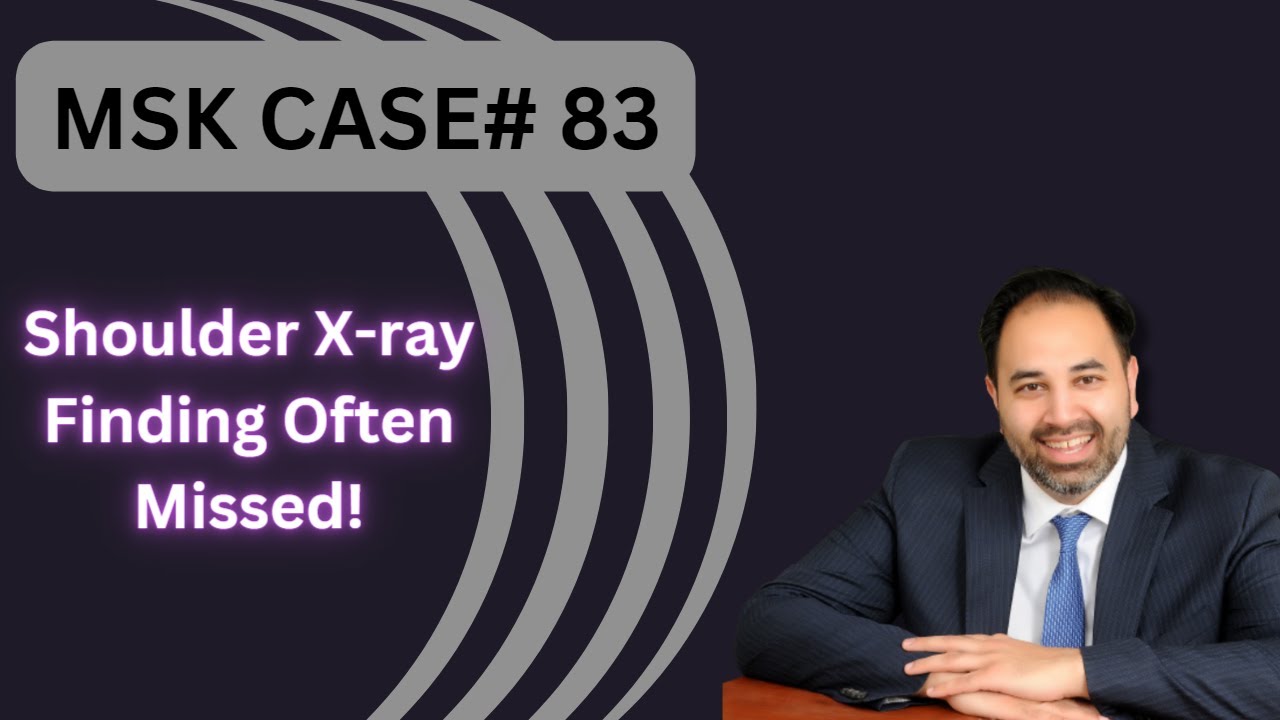 MSK CASE #83- Shoulder X-Ray You Will Not Believe!