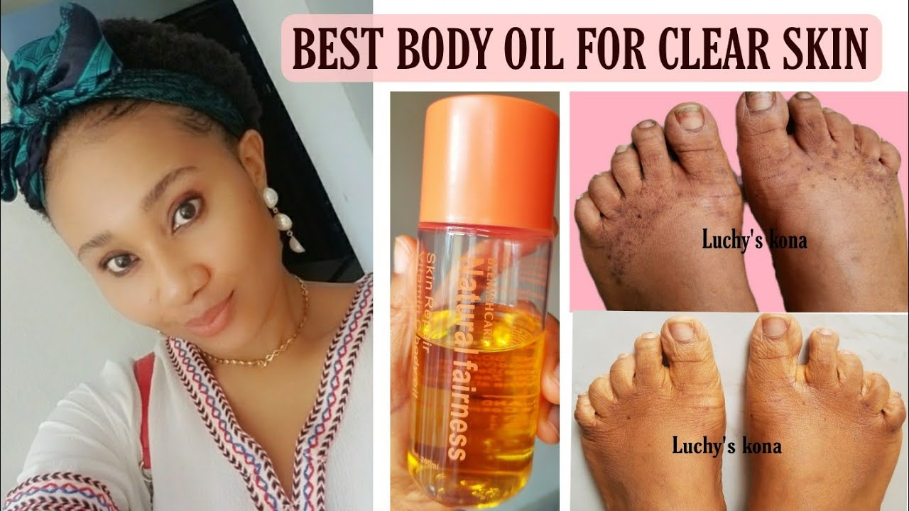 BODY OIL FOR CLEAR SKIN.skincare body oil,how to get rid of dark spots on body.#skincare#clearskin
