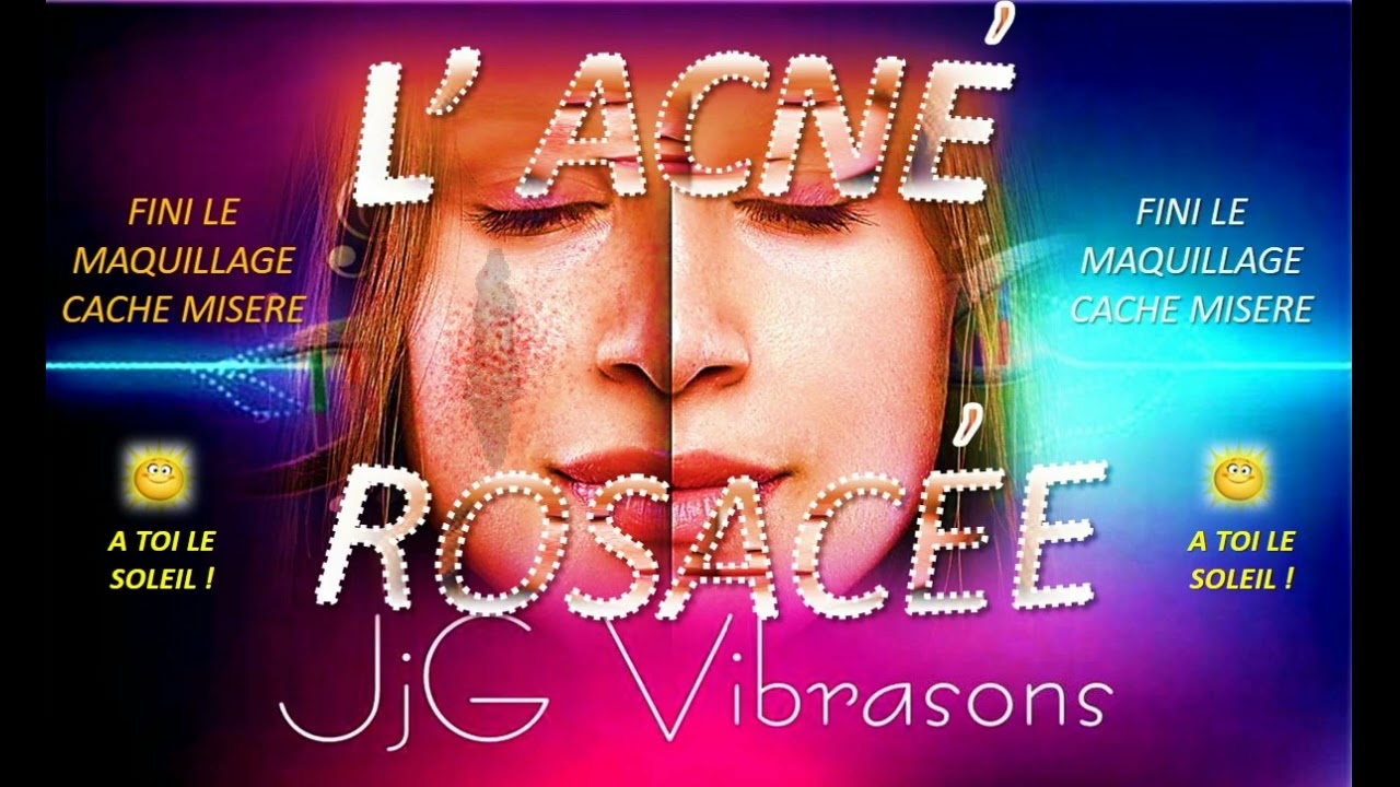 L’ACNÉ ROSACÉE ou L’ACNÉ ROSE ASSEZ ?