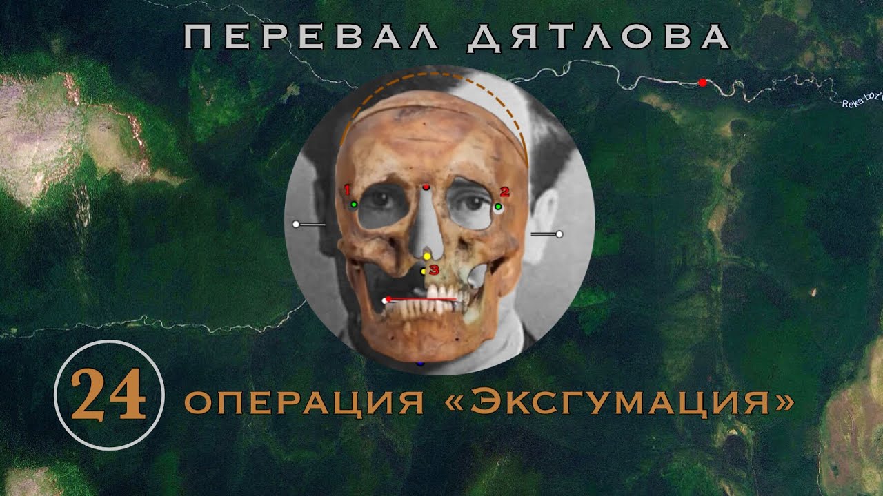 #24 Операция 