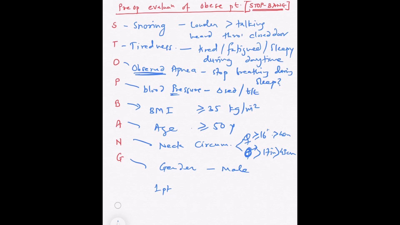 Obese: STOP BANG mnemonic