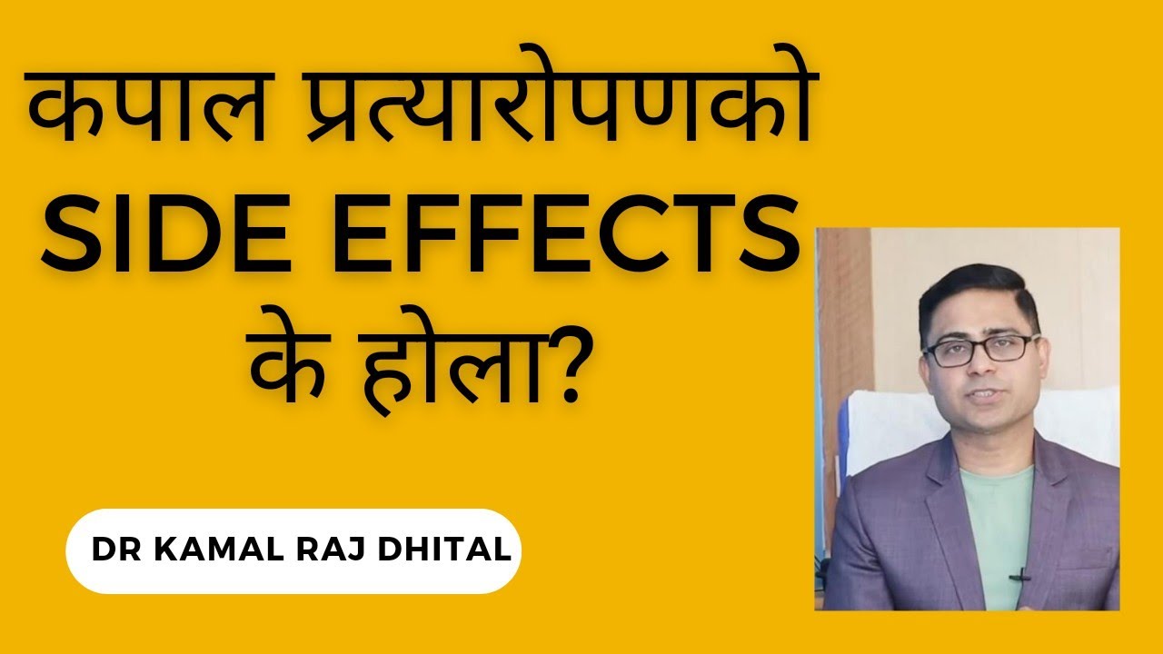hair transplant in Nepal results and side effects कपाल प्रत्यारोपणको कुनै असर हुन्छ ?