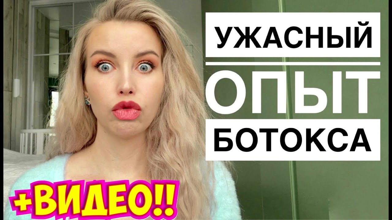 КАК МЕНЯ ПЕРЕКОСИЛО: УЖАСЫ БОТОКСА. ЛИЧНАЯ ИСТОРИЯ + ВИДЕО / Косметология и морщины