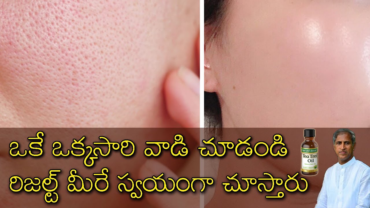 Benefits of Tea Tree Oil | Acne | Get Rid Of Pimples | Sanitizer | Dr Manthena Satyanarayana Raju