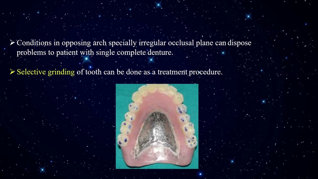 SINGLE COMPLETE DENTURE