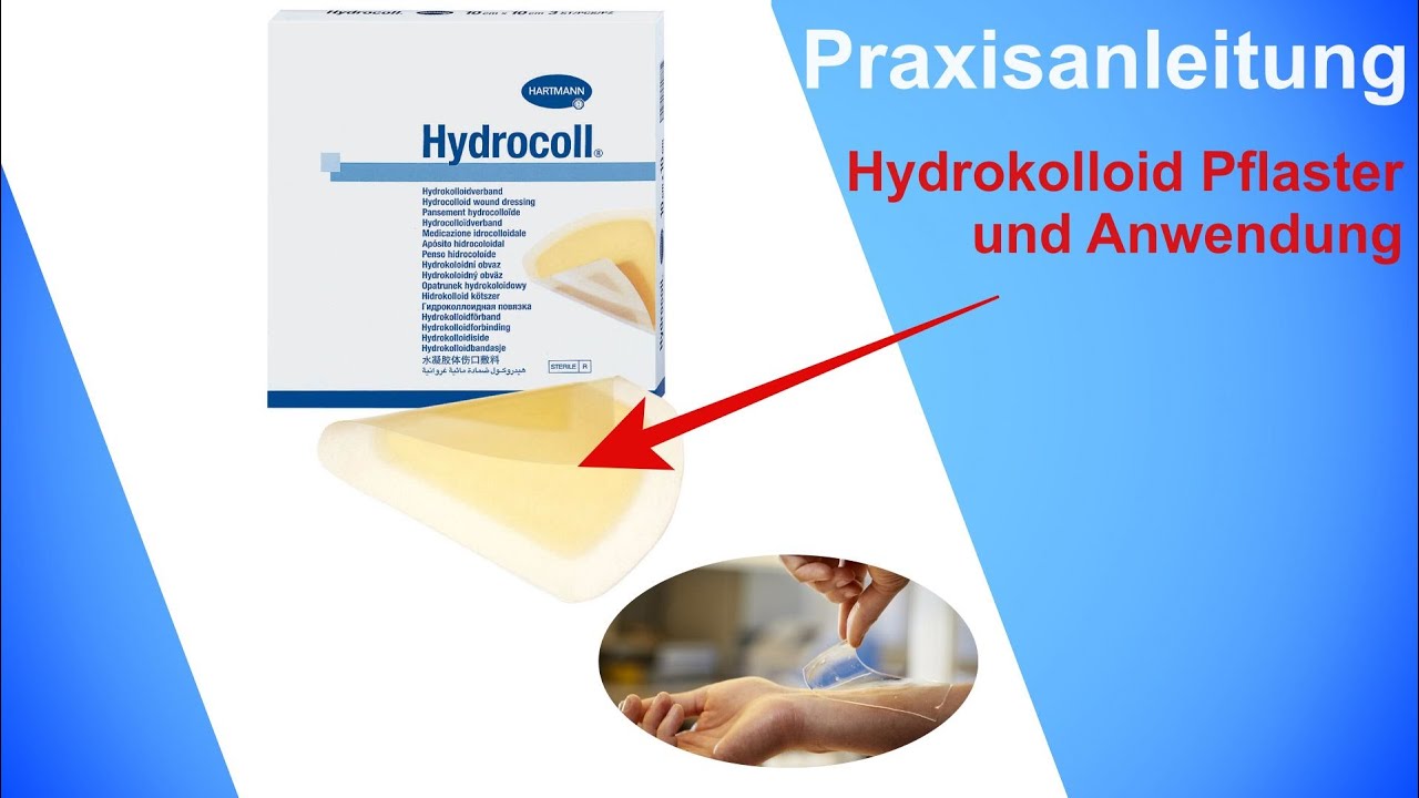 Praxisanleitung - Hydrokolloid-Auflagen erklärt: Anwendung, Vorteile und Beispiele