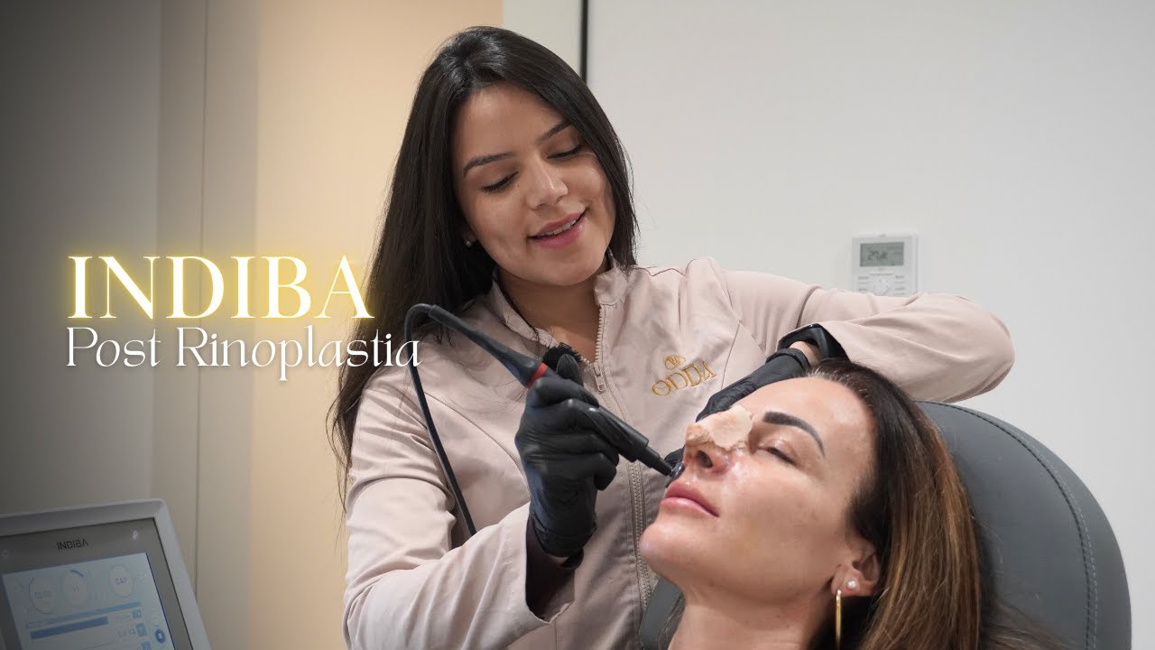 INDIBA POST RINOPLASTIA