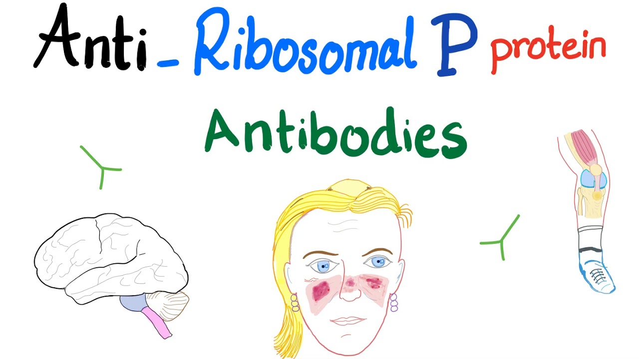 Anti-Ribosomal P Protein Antibodies