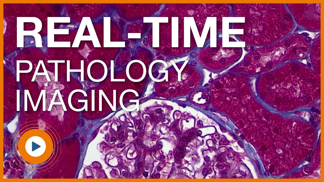 Clinical Pathology Microscope Video